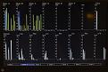 Click image for larger version

Name:	dfcsuperstemmeters400.jpg
Views:	1919
Size:	17.4 KB
ID:	5416